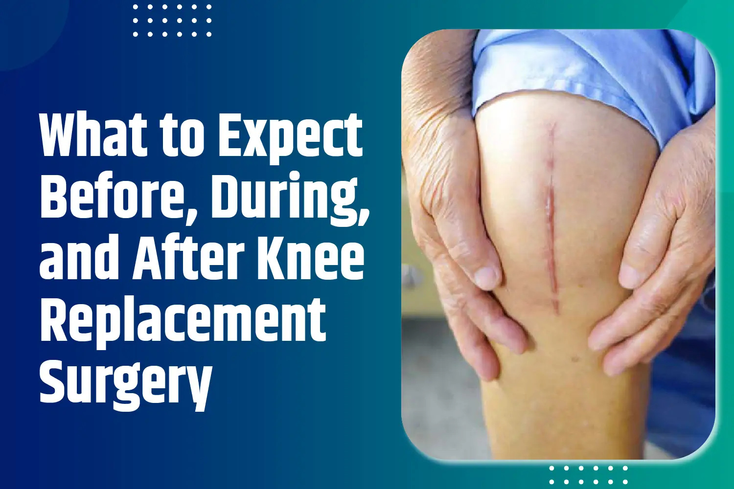 Knee Replacement Surgery