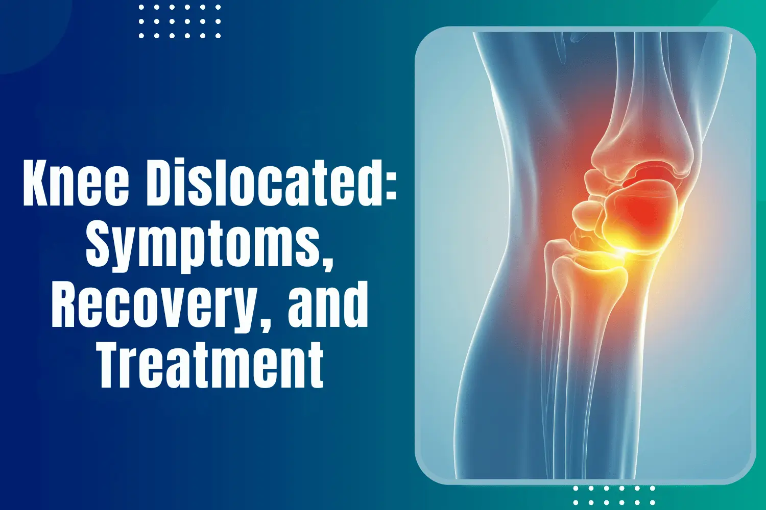 Knee Dislocated: Symptoms, Recovery, and Treatment